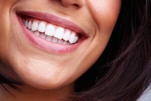 lower half of a woman's face, smiling showing off her new veneers